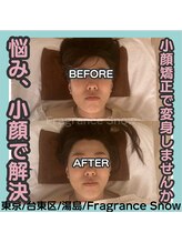 フレグランス スノウ 上野 湯島店(Fragrance Snow)/BeforeAfter5