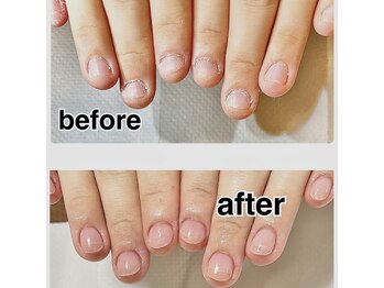 ネイルサロンアンドスクールラボ(LABO)/深爪を本気でよくしたい方に☆