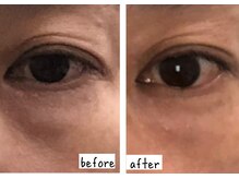 シフク鍼灸整体院/40代女性（加工なし）