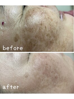 フェアリーヘア ニーナ(Fairy Hair Ni-na)/お客様お写真ビフォー・アフター