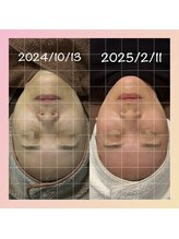 ミヨン(Miyong)/老け見えストップ！