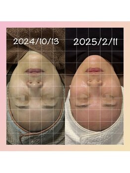 ミヨン(Miyong)/老け見えストップ!