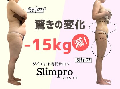 スリムプロの写真