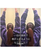 亀太郎鍼灸整体院 津志田院/肩関節の可動域向上◎