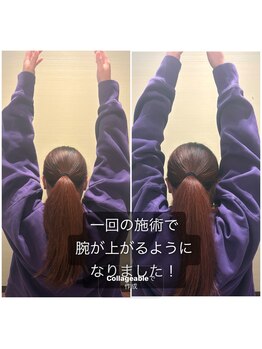 亀太郎鍼灸整体院 津志田院/肩関節の可動域向上◎