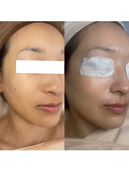 お肌想いラボ/お客様症例写真