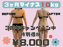 エイム(Aim)