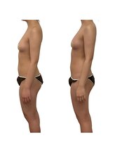 ベンザイ 新潟店(BENZAI)/猫背とさよなら！整体もできる１