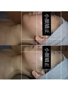 ルピナス 立川店/脂肪撃退アンプルでスッキリ