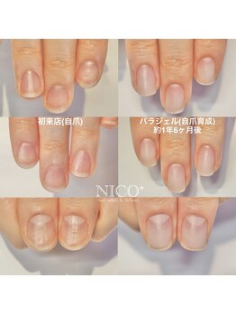 ニコプラス(NICO+)/自爪育成中