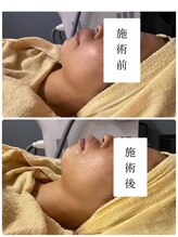 肌音色/■カスマラパック施術例