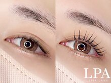 レピア 仙台店/韓国式LEPIA Before&Aｆter