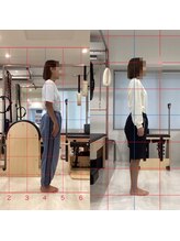 デップ 宮崎店(DEP)/2回目での変化♪