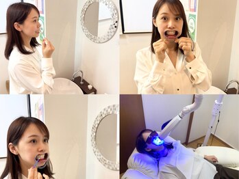 スマイルラボ 金沢店の写真/短期間で効果実感★大切なイベント前に！コーヒーやタバコで黄ばんだ歯をセルフホワイトニングで輝く歯へ！
