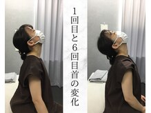 リバティ 世田谷代田整体院(Liberty)/肩甲骨はがし「首の動きアップ」
