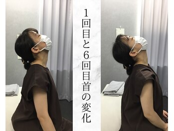 リバティ 世田谷代田整体院(Liberty)/肩甲骨はがし「首の動きアップ」