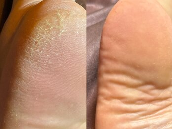 サラグランデ(Sara Grande)/赤ちゃん足裏復活！