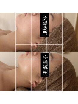 ルピナス 立川店/脂肪撃退アンプルでスッキリ