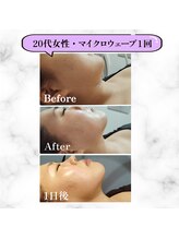 グランディールアン(GRANDIR UN)/1日で小顔