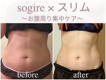 エステティックサロン アールグレー 名古屋駅店/2種の痩身メニューで結果出し/腹