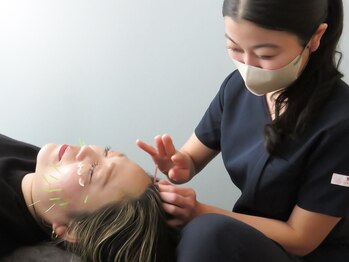 J&Mリラクシング(J&M relaxing)の写真/【圧倒的リフトアップ効果！電気を流す美容鍼+小顔矯正￥6600】気になるお顔のたるみ/むくみに"速"実感！