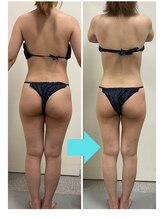 エスビーエス オキナワ(SBS OKINAWA)/痩身モニター様