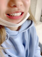 ライトビューティー 本八幡店(LIGHT BEAUTY)/白い歯って素敵！