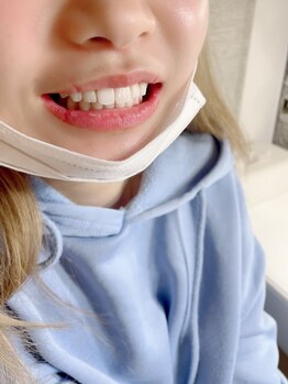 ライトビューティー 本八幡店(LIGHT BEAUTY)/白い歯って素敵!