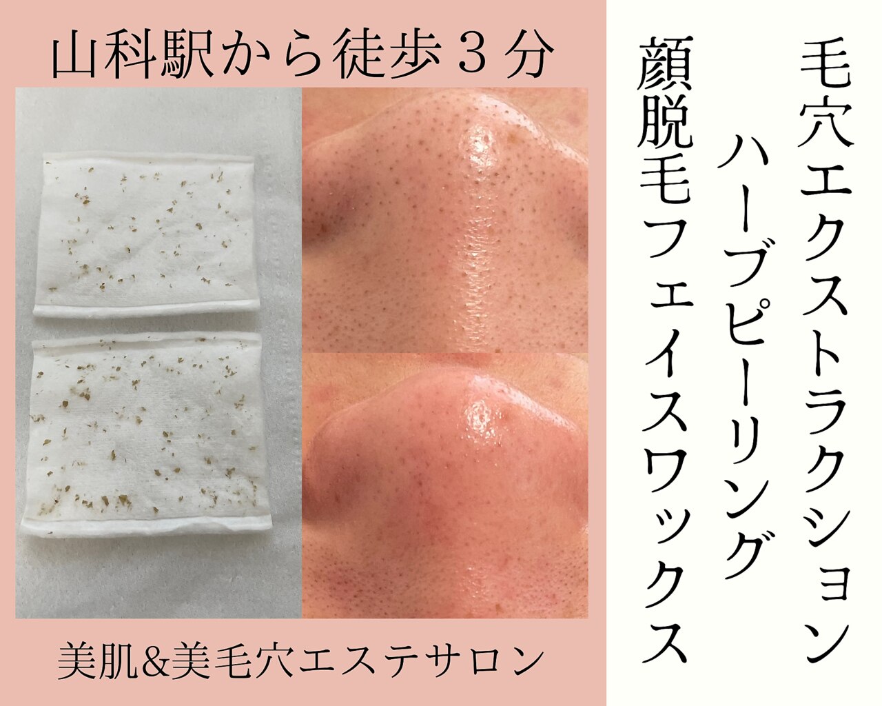 毛穴ケアサロン そらな｜ホットペッパービューティー