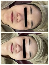 ジャスミン(Jasmin)/バリア機能改善ケア