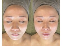 サプナジー(Suppnrgy)/クレンズコルギ1回