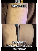 フーレスト アンド フリーリー(Fullest&Freely)/脱毛