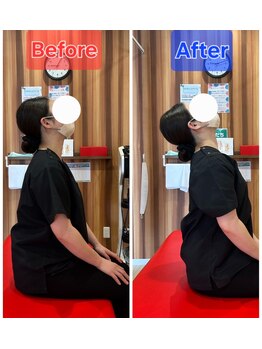 みらい整体院 山形南院/Before　After