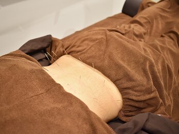 市川くじら鍼灸院/鍼灸