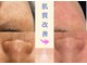 フットミー(foot mii)の写真/土台を本気改善！毛穴洗浄で、肌を育てながらクリアな毛穴へ☆毛穴やしみが気になる方◎