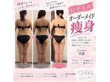 リアン(lien)の雰囲気（キャビや吸引RF、など多数の美容器械を取り揃えております。）