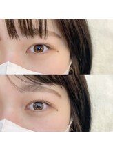 フランセス(Frances)/ラッシュリフト