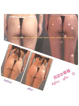 アンレーヴ/ハイパー痩身ショート