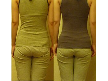 里の整体 京都/数回の通院で歪みも体型も改善♪