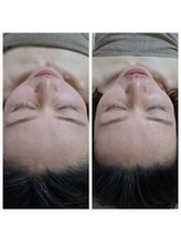 ネマウム(nemaum)/脳美容(ドライヘッドスパ)