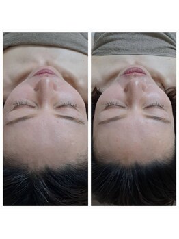 ネマウム(nemaum)/脳美容(ドライヘッドスパ)