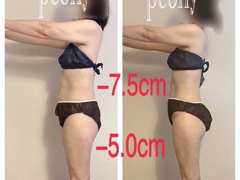 ピオニー(PEONY)/【痩身】サイズダウン 短期集中