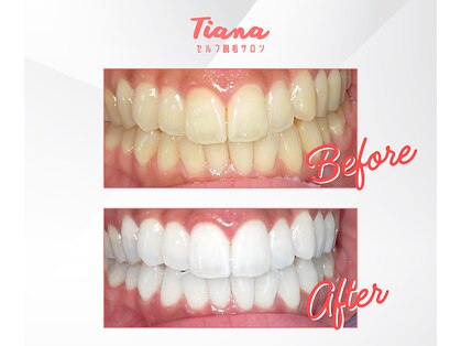 ティアナ 高知店(Tiana)の写真