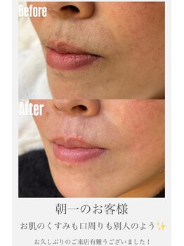 エリス(ELISSE)/くすみゼロ!毛穴も引き締める!