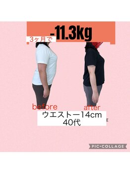 ヴェリテ(Verite)/before after