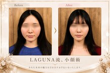 ラグナ(LAGUNA)