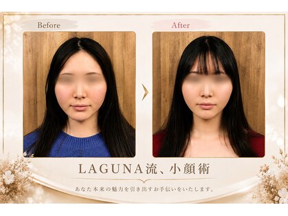 ラグナ(LAGUNA)の写真