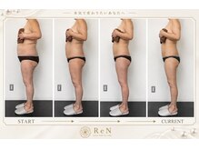 レン(ReN)/ビフォーアフター