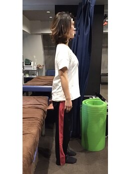 ディアパーソン アクティブ(Dear Person Active)/ストレッチ施術後の立位姿勢