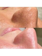 エトレ(ETOLE)/叶える！ちゅる肌☆